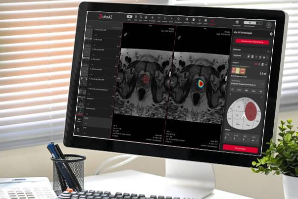 ALTA AI Software – Forschung und Entwicklung der KI-gestützten MRT-Analyse