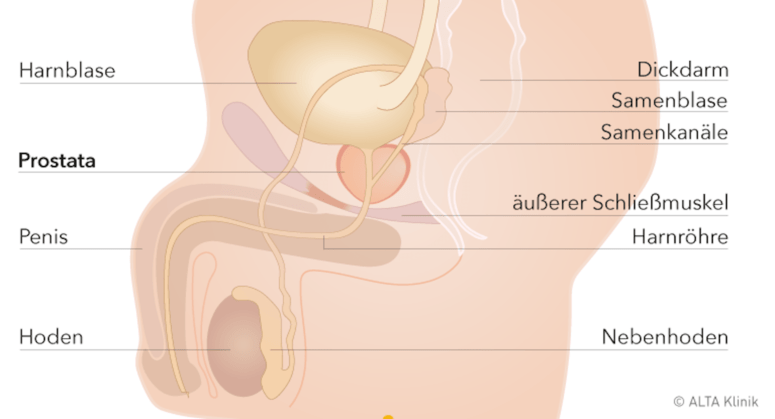 Prostatitis vitaon, Vitaon prosztatagyulladás és impotencia kezelésére