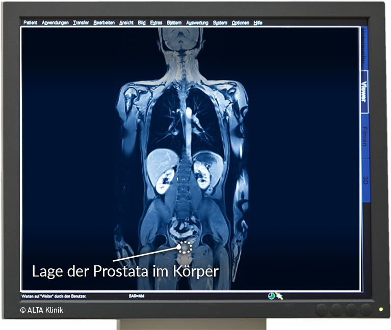 prostata anatomie mrt)