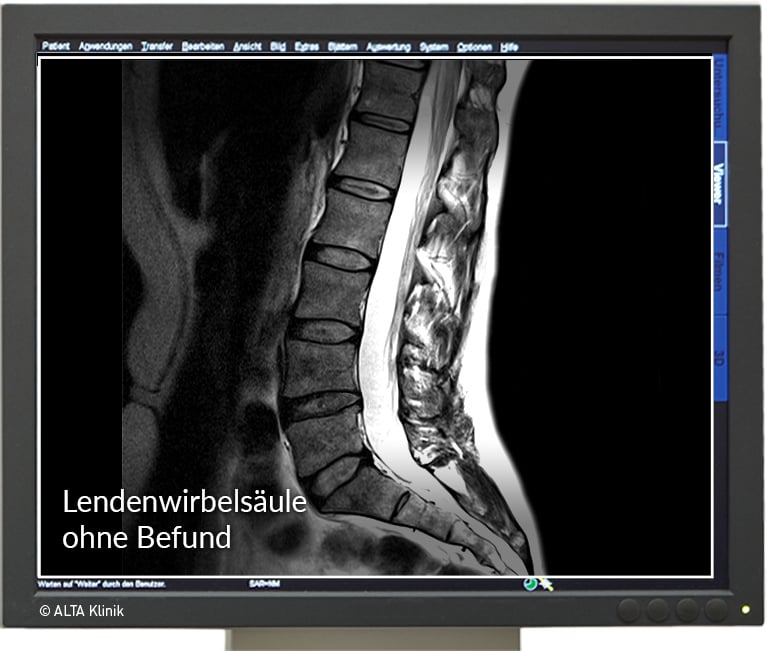MRT-Wirbelsäule - Die Ursachen für Rückenschmerzen finden