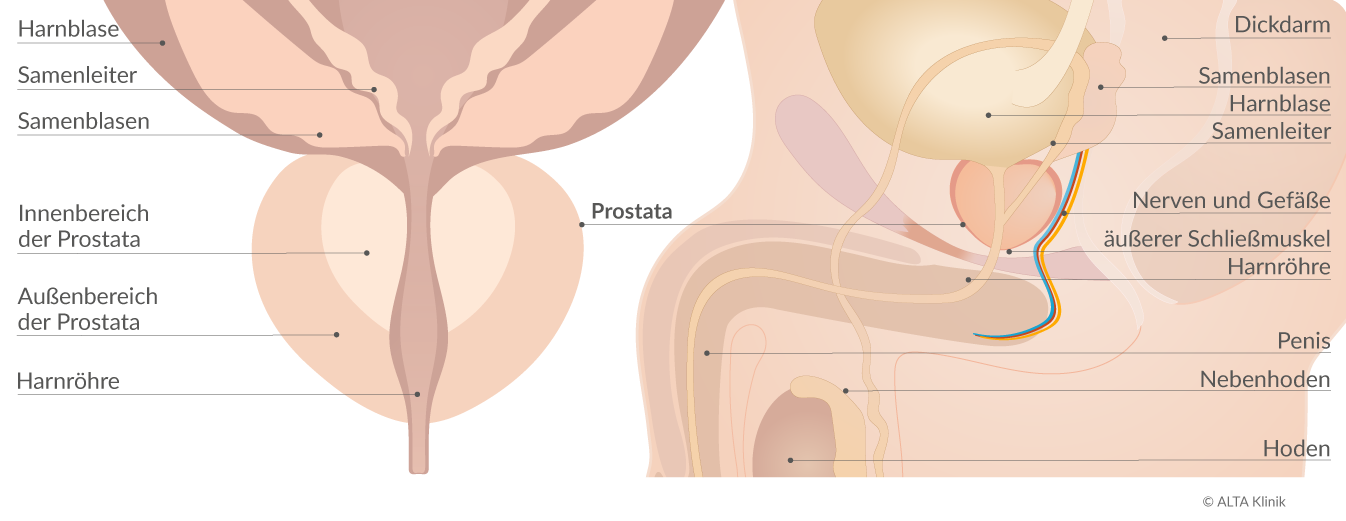 A mágneses rezonanciás vizsgálat (MRI) szerepe prosztatarák megítélésében