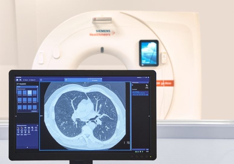 CT-Untersuchung der Lunge