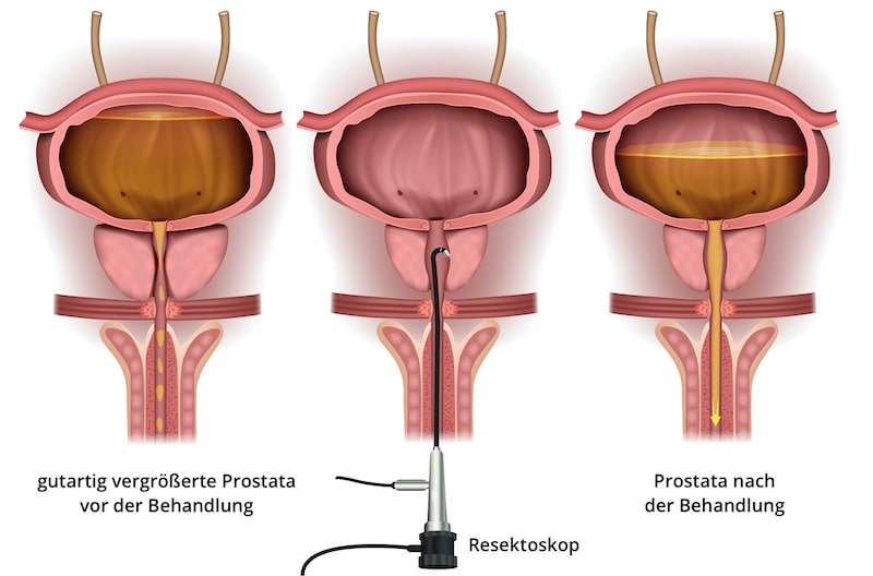 selbst prostata befriedigen Prostatamassage: Vorteile & Anleitung main image 0