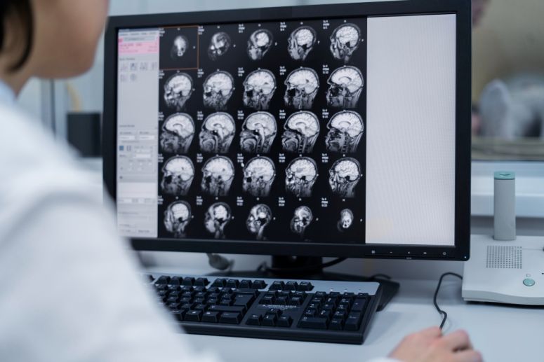 Alzheimer Symptome